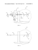 Tissue Localization Device and Method diagram and image