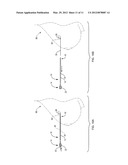 Tissue Localization Device and Method diagram and image