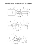 APPARATUS AND METHODS FOR TREATING OBSTRUCTIONS WITHIN BODY LUMENS diagram and image