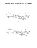 APPARATUS AND METHODS FOR TREATING OBSTRUCTIONS WITHIN BODY LUMENS diagram and image