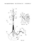 SYSTEMS AND METHODS FOR ANALYSIS AND TREATMENT OF A BODY LUMEN diagram and image