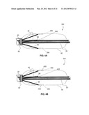 SYSTEMS AND METHODS FOR ANALYSIS AND TREATMENT OF A BODY LUMEN diagram and image