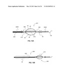 SYSTEMS AND METHODS FOR ANALYSIS AND TREATMENT OF A BODY LUMEN diagram and image