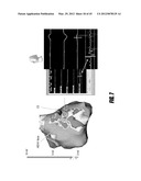 METHOD FOR DETERMINING THE LOCATION OF REGIONS IN TISSUE RELEVANT TO     ELECTRICAL PROPAGATION diagram and image