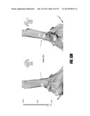 METHOD FOR DETERMINING THE LOCATION OF REGIONS IN TISSUE RELEVANT TO     ELECTRICAL PROPAGATION diagram and image