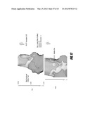 METHOD FOR DETERMINING THE LOCATION OF REGIONS IN TISSUE RELEVANT TO     ELECTRICAL PROPAGATION diagram and image