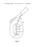 METHODS AND SYSTEMS FOR CONTROLLED DEPLOYMENT OF NEEDLES IN TISSUE diagram and image