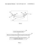 ELEMENT FOR IMPLANTATION WITH MEDICAL DEVICE diagram and image