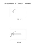 ELEMENT FOR IMPLANTATION WITH MEDICAL DEVICE diagram and image