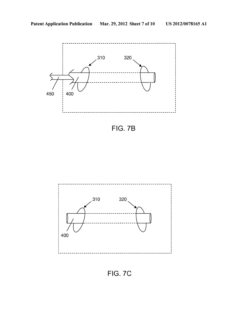 ELEMENT FOR IMPLANTATION WITH MEDICAL DEVICE - diagram, schematic, and image 08