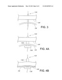 Multi-Balloon Dilation Device for Placing Catheter Tubes diagram and image