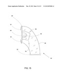 Contained ostomy appliance diagram and image