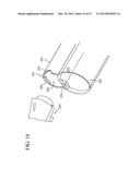 Dual Chamber Syringe With Retractable Needle diagram and image