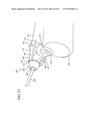 Dual Chamber Syringe With Retractable Needle diagram and image