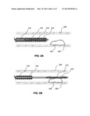 LOCAL DELIVERY OF WATER-SOLUBLE OR WATER-INSOLUBLE THERAPEUTIC AGENTS TO     THE SURFACE OF BODY LUMENS diagram and image