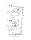 Surgical Navigation System diagram and image