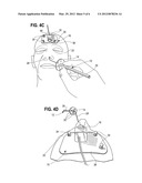 Surgical Navigation System diagram and image