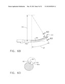 ULTRASONIC DEVICE FOR CUTTING AND COAGULATING diagram and image