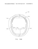 ULTRASONIC DEVICE FOR CUTTING AND COAGULATING diagram and image