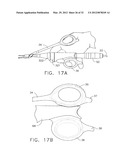 ULTRASONIC DEVICE FOR CUTTING AND COAGULATING diagram and image