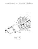 ULTRASONIC DEVICE FOR CUTTING AND COAGULATING diagram and image