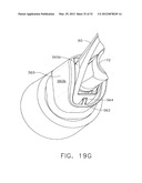 ULTRASONIC DEVICE FOR CUTTING AND COAGULATING diagram and image