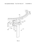 External Fixator Linkage diagram and image