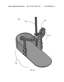 External Fixator Linkage diagram and image