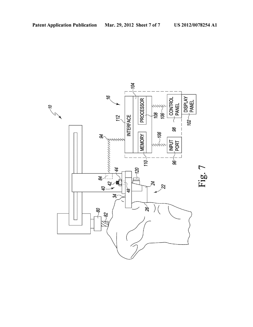 CUSTOMIZED PATIENT-SPECIFIC COMPUTER CONTROLLED CUTTING SYSTEM AND METHOD - diagram, schematic, and image 08