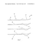 METHOD OF ARTHROPLASTY ON A KNEE JOINT AND APPARATUS FOR USE IN SAME diagram and image