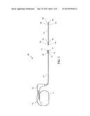 ARCUATE INTRODUCER diagram and image