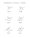 ARCUATE INTRODUCER diagram and image