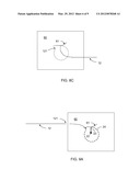 ARCUATE INTRODUCER diagram and image