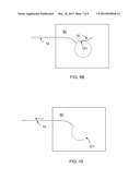 ARCUATE INTRODUCER diagram and image