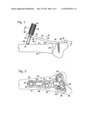 BONE PLATE SUPPORTED BY A LEG MEMBER AND USED AS A LEVER diagram and image