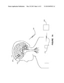 SYSTEM AND APPARATUS FOR INCREASING REGULARITY AND/OR PHASE-LOCKING OF     NEURONAL ACTIVITY RELATING TO AN EPILEPTIC EVENT diagram and image