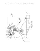 SYSTEM AND APPARATUS FOR INCREASING REGULARITY AND/OR PHASE-LOCKING OF     NEURONAL ACTIVITY RELATING TO AN EPILEPTIC EVENT diagram and image