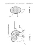 SYSTEM AND APPARATUS FOR INCREASING REGULARITY AND/OR PHASE-LOCKING OF     NEURONAL ACTIVITY RELATING TO AN EPILEPTIC EVENT diagram and image