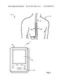 IDENTIFYING COMBINATIONS OF ELECTRODES FOR NEUROSTIMULATION THERAPY diagram and image