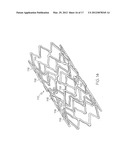 LONGITUDINALLY FLEXIBLE EXPANDABLE STENT diagram and image