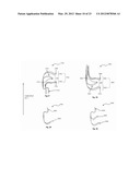 PROSTHETIC DEVICES, SYSTEMS AND METHODS FOR REPLACING HEART VALVES diagram and image