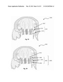 PROSTHETIC DEVICES, SYSTEMS AND METHODS FOR REPLACING HEART VALVES diagram and image