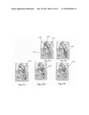 PROSTHETIC DEVICES, SYSTEMS AND METHODS FOR REPLACING HEART VALVES diagram and image