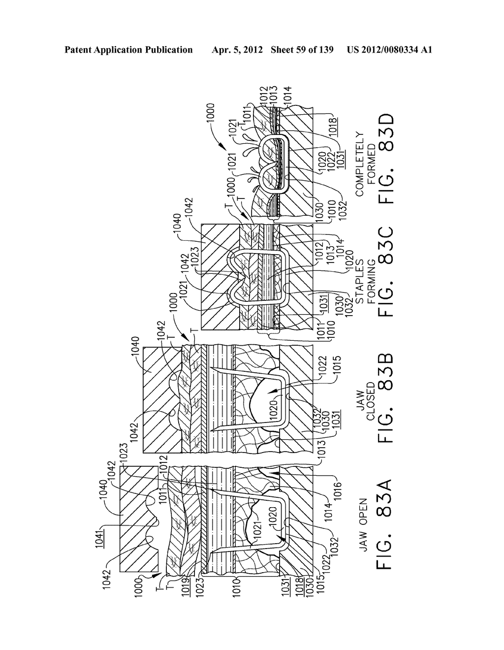 SELECTIVELY ORIENTABLE IMPLANTABLE FASTENER CARTRIDGE - diagram, schematic, and image 60