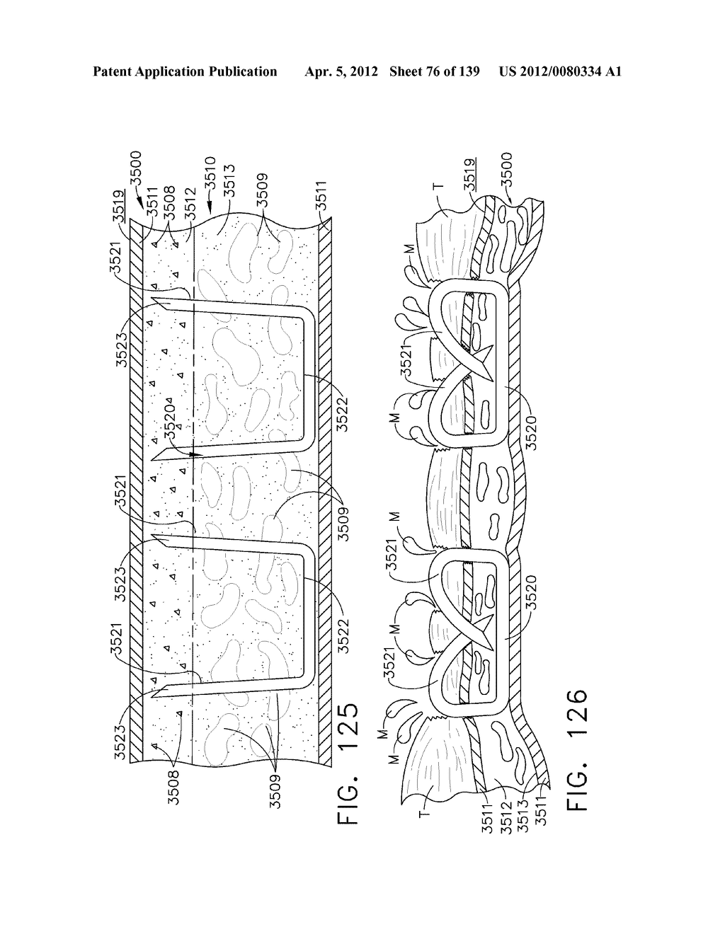 SELECTIVELY ORIENTABLE IMPLANTABLE FASTENER CARTRIDGE - diagram, schematic, and image 77