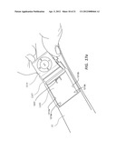 Wearable Band for Receiving a Clip-On Device, Docking Accessories, and     Methods of Use diagram and image