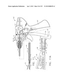 SURGICAL STAPLE CARTRIDGES WITH DETACHABLE SUPPORT STRUCTURES AND SURGICAL     STAPLING INSTRUMENTS WITH SYSTEMS FOR PREVENTING ACTUATION MOTIONS WHEN A     CARTRIDGE IS NOT PRESENT diagram and image