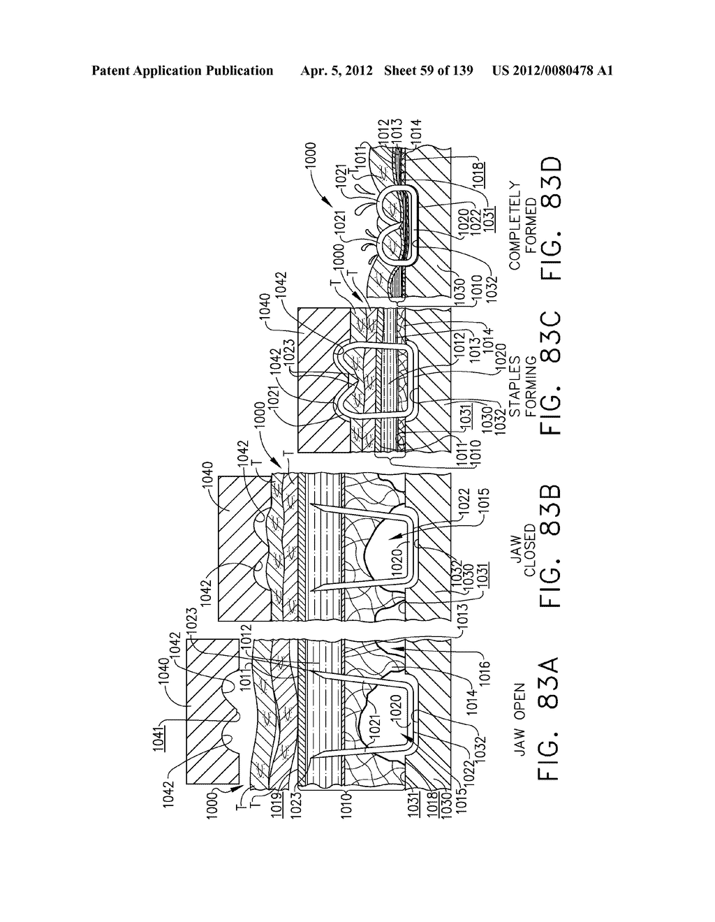 SURGICAL STAPLE CARTRIDGES WITH DETACHABLE SUPPORT STRUCTURES AND SURGICAL     STAPLING INSTRUMENTS WITH SYSTEMS FOR PREVENTING ACTUATION MOTIONS WHEN A     CARTRIDGE IS NOT PRESENT - diagram, schematic, and image 60