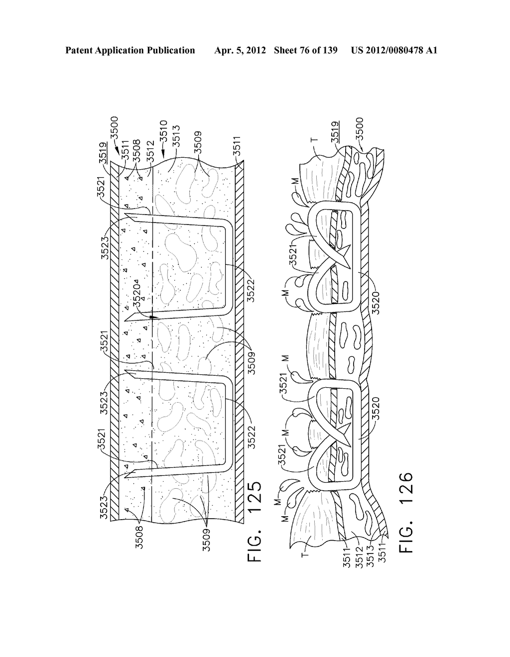 SURGICAL STAPLE CARTRIDGES WITH DETACHABLE SUPPORT STRUCTURES AND SURGICAL     STAPLING INSTRUMENTS WITH SYSTEMS FOR PREVENTING ACTUATION MOTIONS WHEN A     CARTRIDGE IS NOT PRESENT - diagram, schematic, and image 77