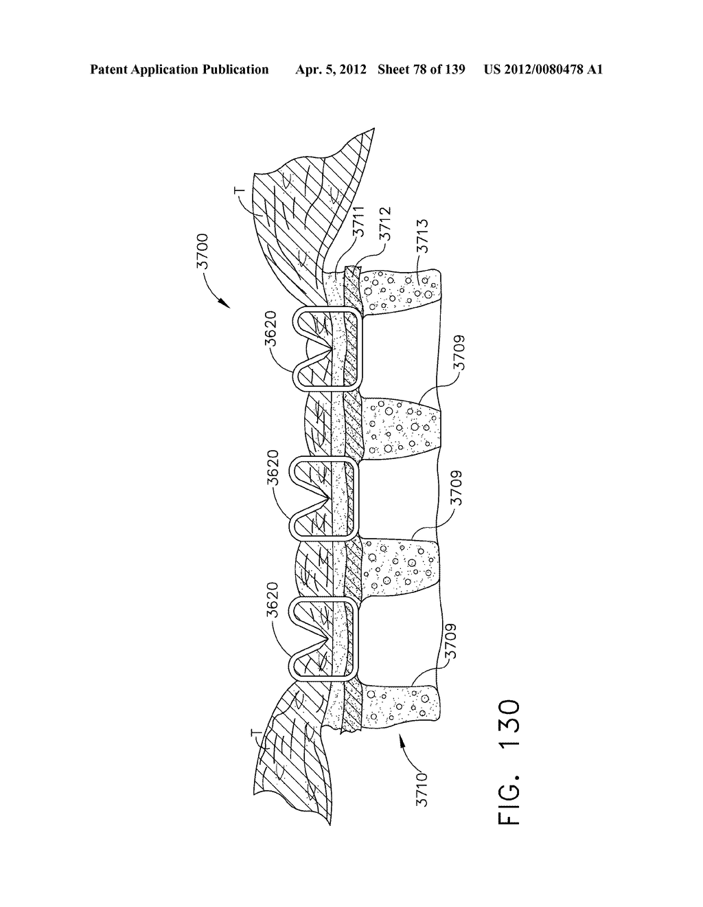 SURGICAL STAPLE CARTRIDGES WITH DETACHABLE SUPPORT STRUCTURES AND SURGICAL     STAPLING INSTRUMENTS WITH SYSTEMS FOR PREVENTING ACTUATION MOTIONS WHEN A     CARTRIDGE IS NOT PRESENT - diagram, schematic, and image 79